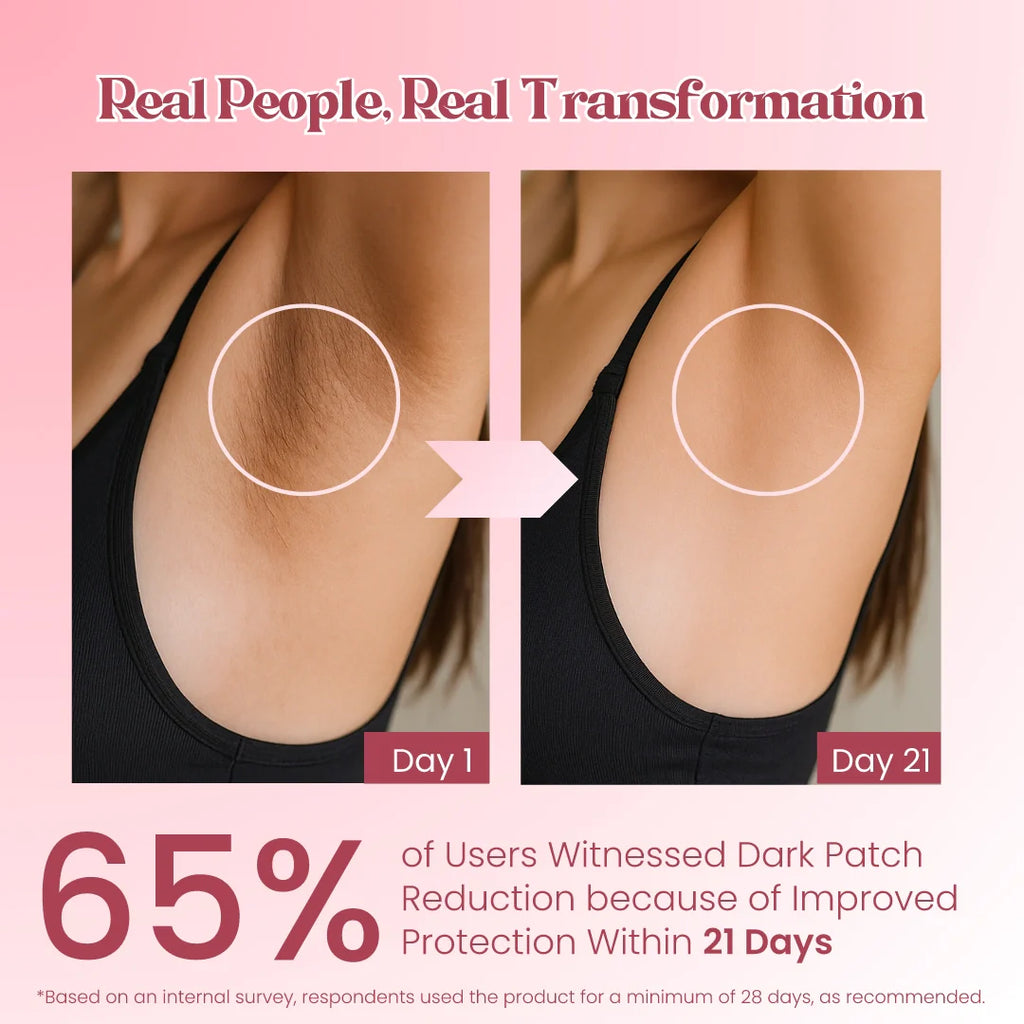 Dark Patch Reducer Cream