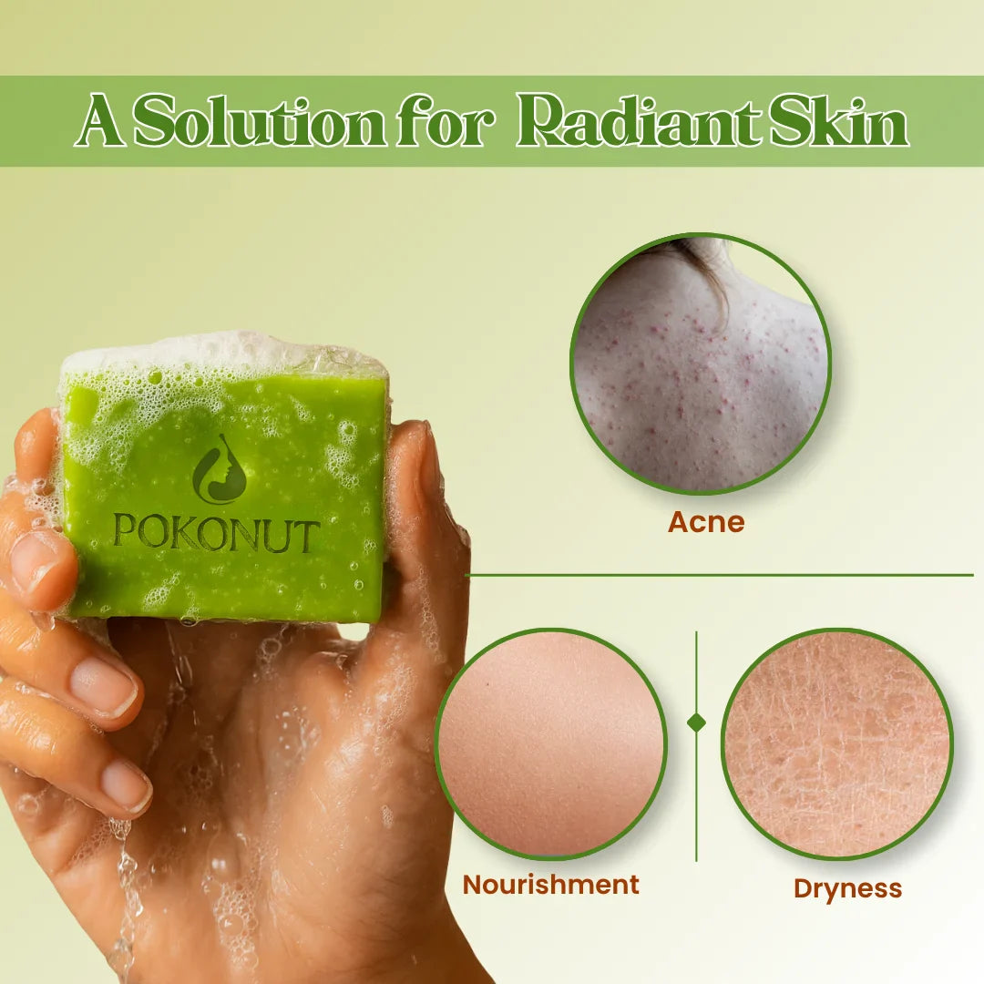 Anti acne soap -100g